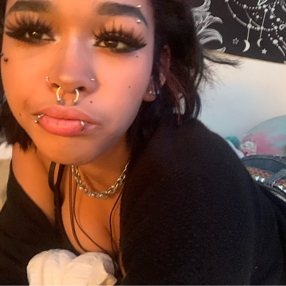 chloewithbraces